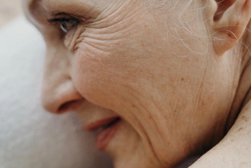 Inflammageing – Silent Inflammation and Its Effects on Ageing and the Skin